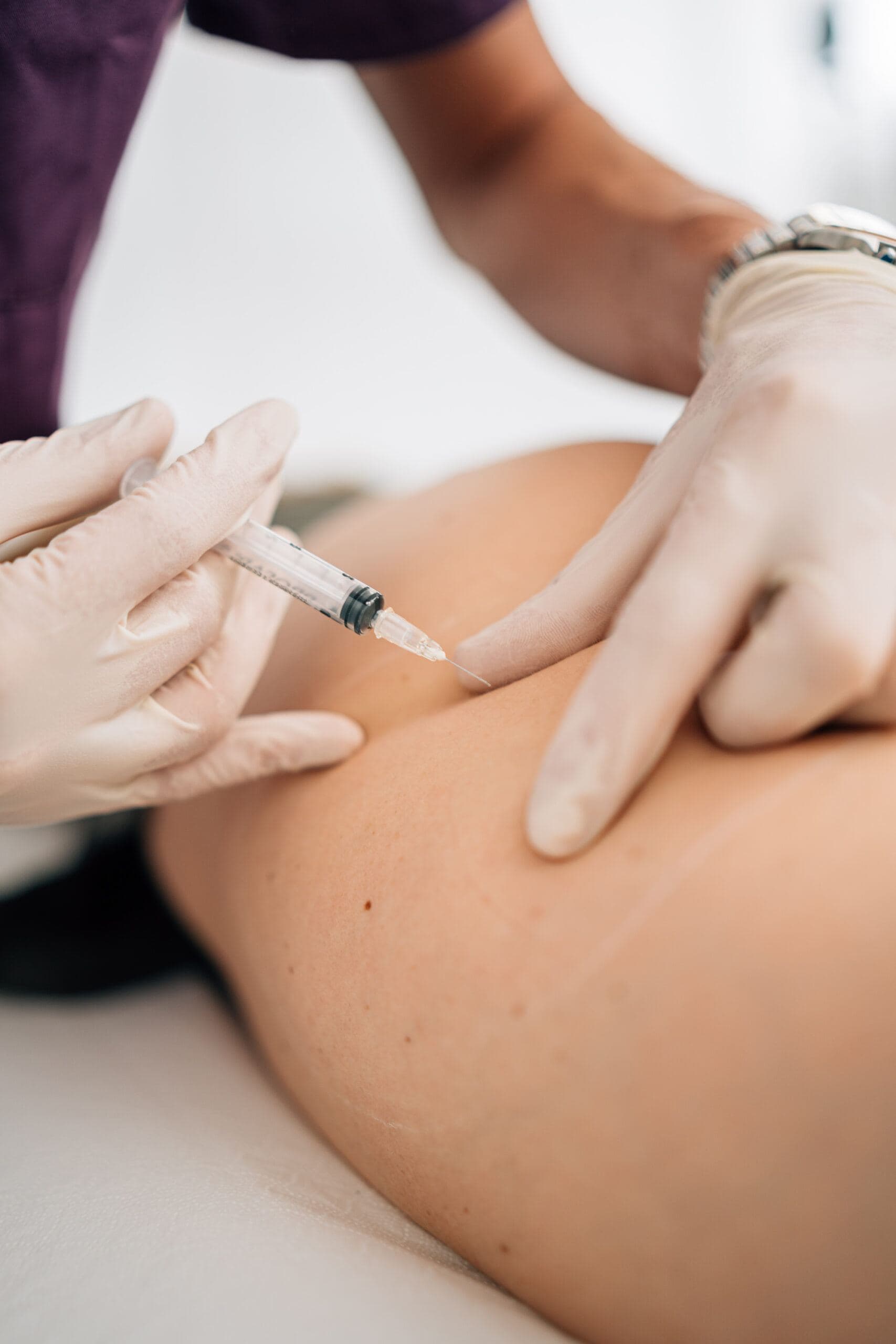 Mesoterapia Dr. Simone Saretta